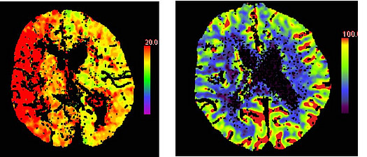Neuroradiologie - CT Aufnahmen (medbo | Isabel Wiesinger)